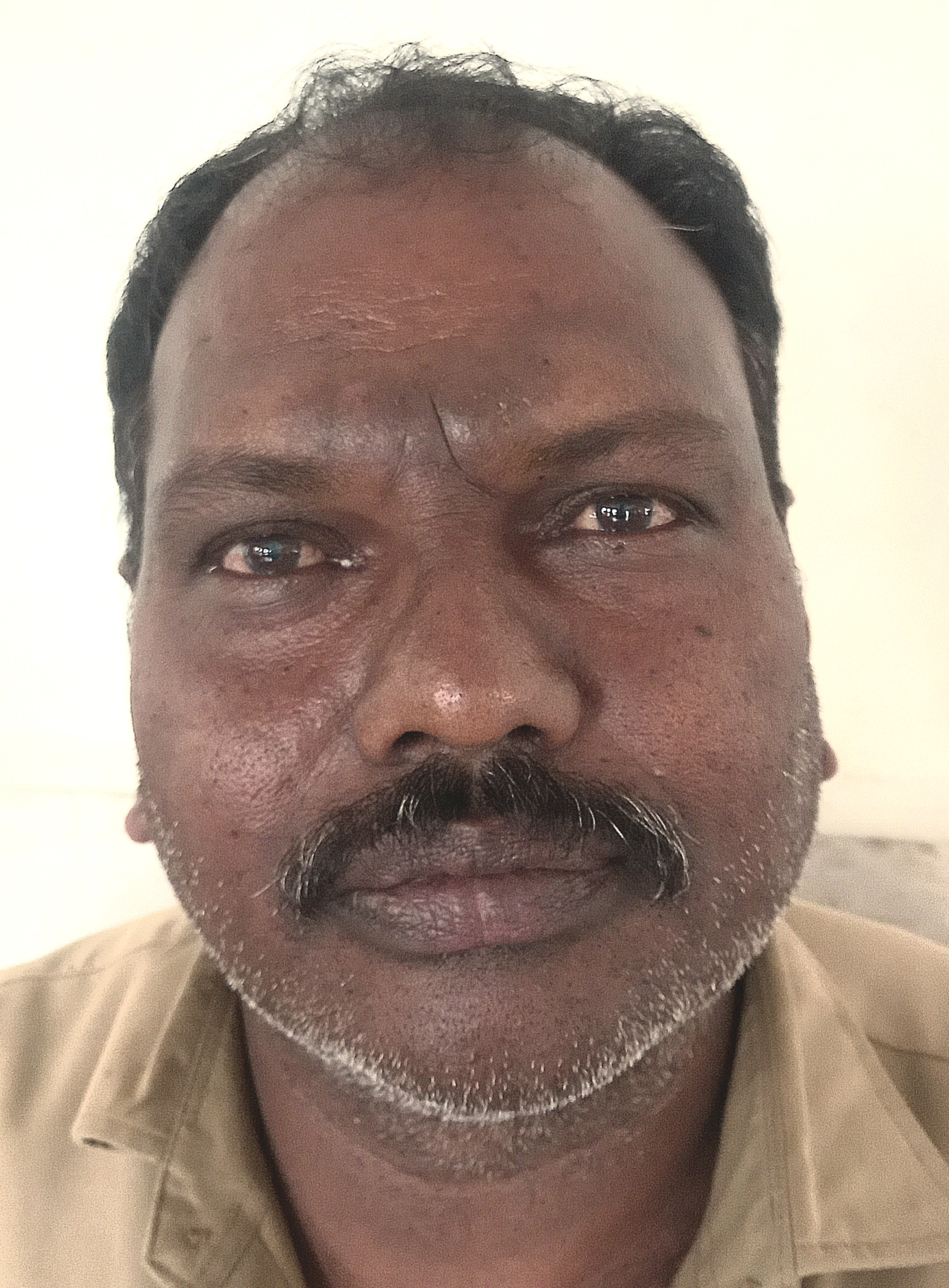 MANCHALA YADGIRI BIKSHAPATHI